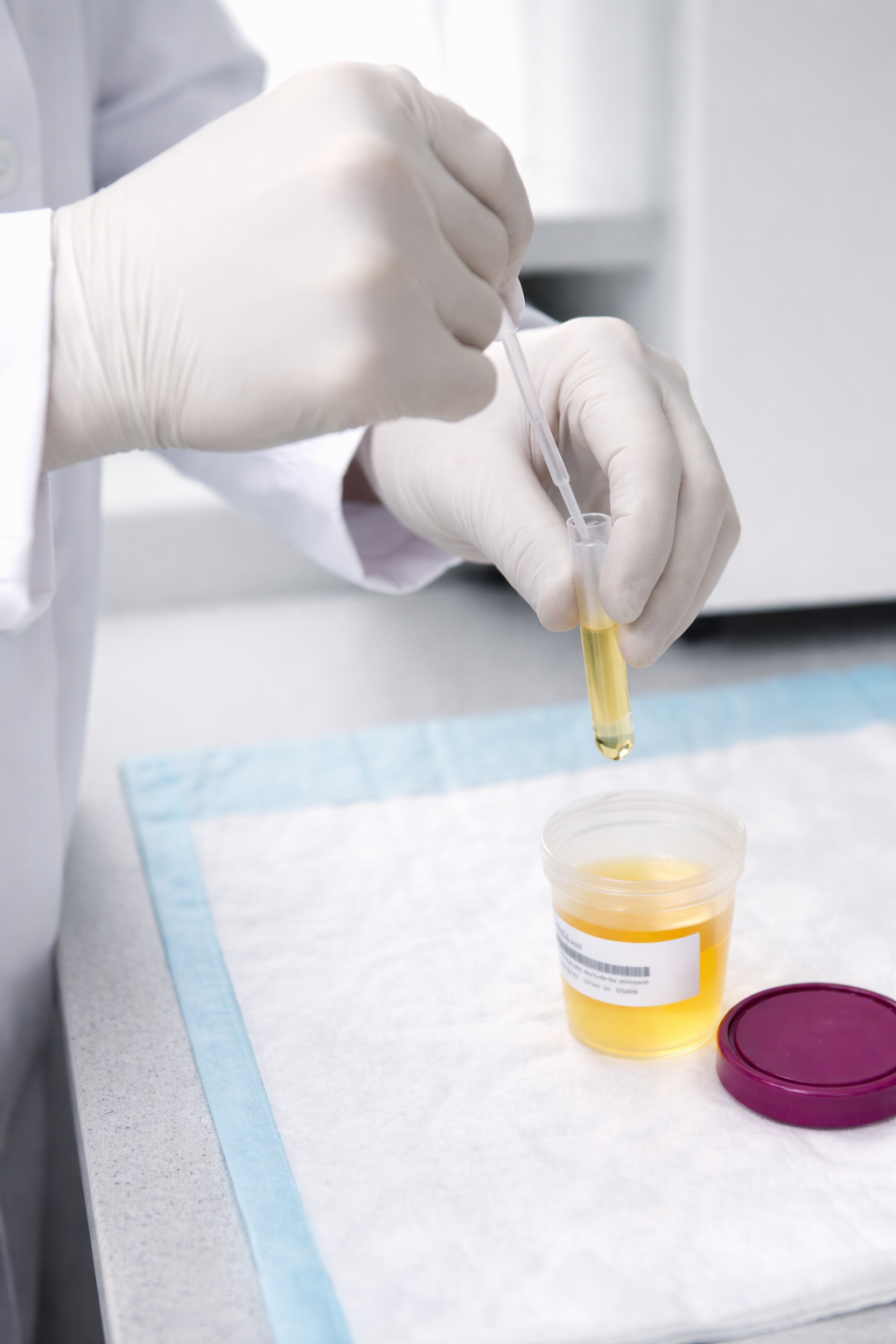 Paket Promo Narkoba 3 Parameter